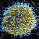 Ebola pandemic in 2026?